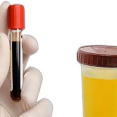 Medical Grade Creatinine Chemical